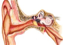 Gangguan Pendengaran:Mengatasi Pemahaman dan Solusi