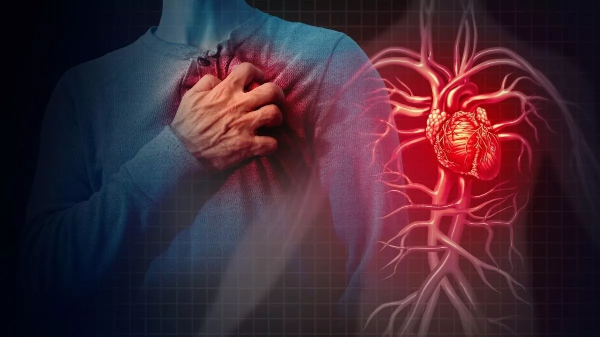 Penyakit Arteri Koroner: Penyumbatan arteri yang dapat menyebabkan Penyebab Henti Jantung mendadak, memerlukan perhatian medis segera