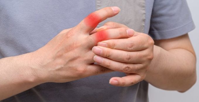 Terapi Asam Urat: Cara Ampuh Redakan Nyeri dan Cegah Kambuh